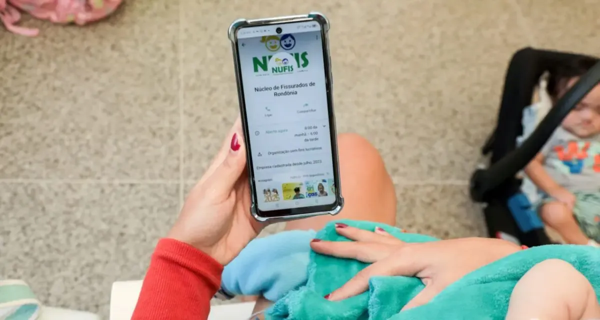 Governo de Rondônia transforma vidas com mais de 300 cirurgias de fissura labiopalatina