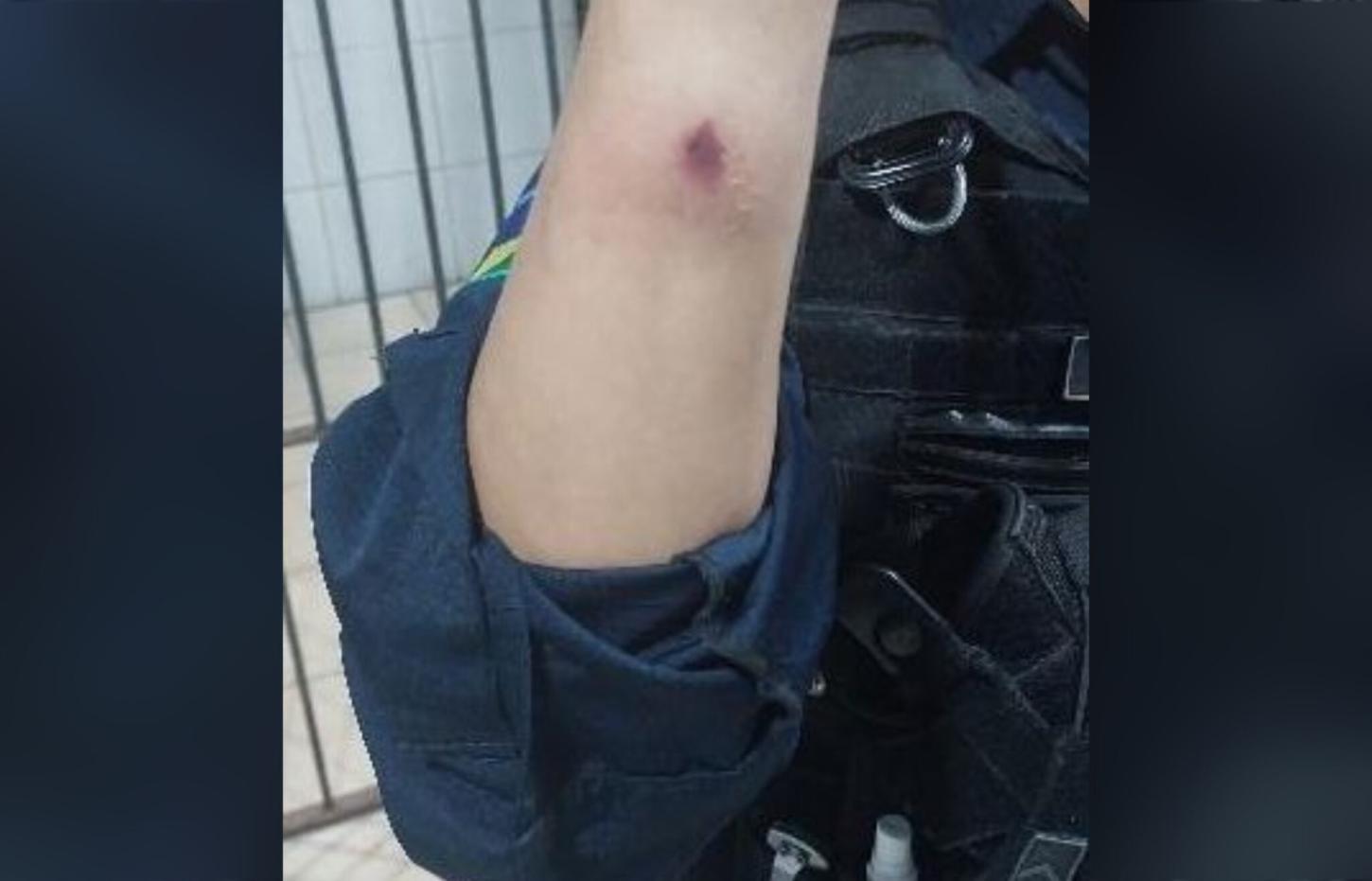 Policial Militar é atacado a mordidas durante registro de ocorrência na zona leste de Porto Velho